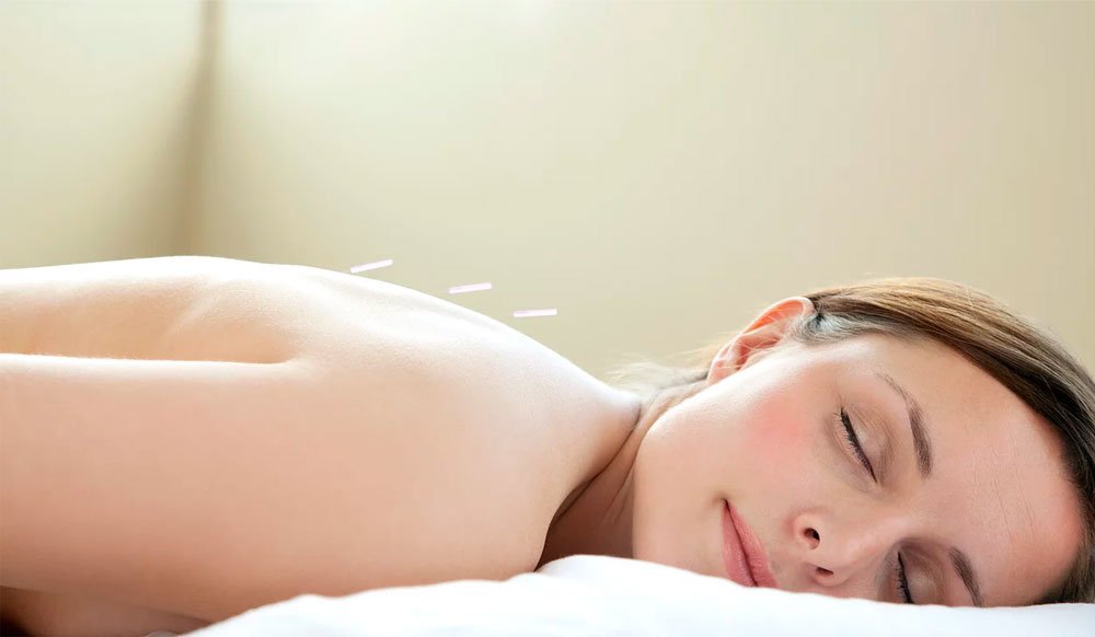 Meta Analysis Shows Acupuncture and Moxibustion together are Superior to Western Medicine for Fibromyalgia